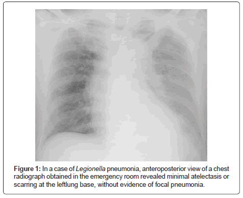 air-water-borne-diseases-anteroposterior