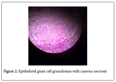 air-water-borne-diseases-epithelioid