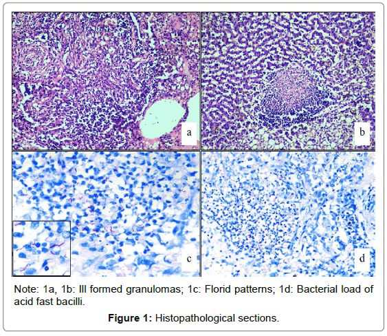 air-water-borne-diseases-histopathological-sections