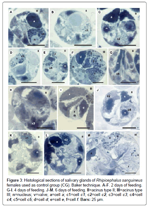 air-water-borne-diseases-salivary