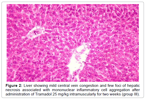 Ivermectin compassionate use