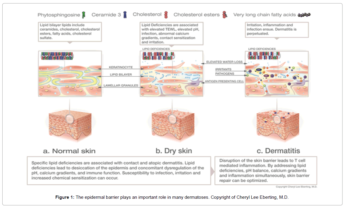 allergy therapy barrier plays copyright duration chart