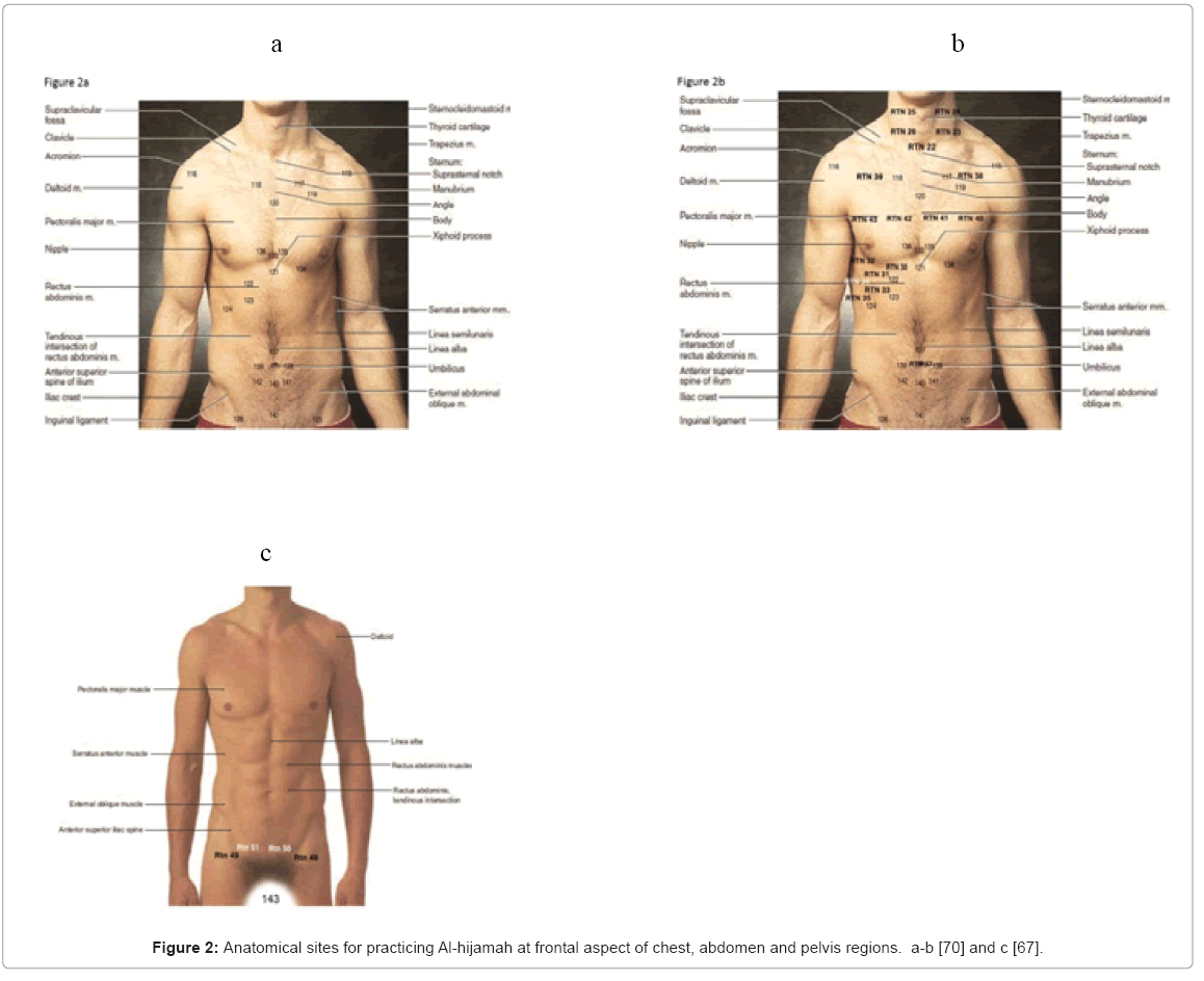 Hijama Sunnah Points Chart