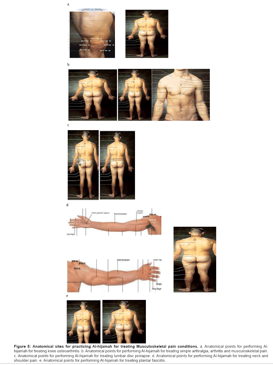 Cupping Points Chart