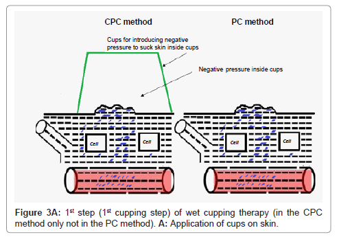 Cupping Points Chart Pdf