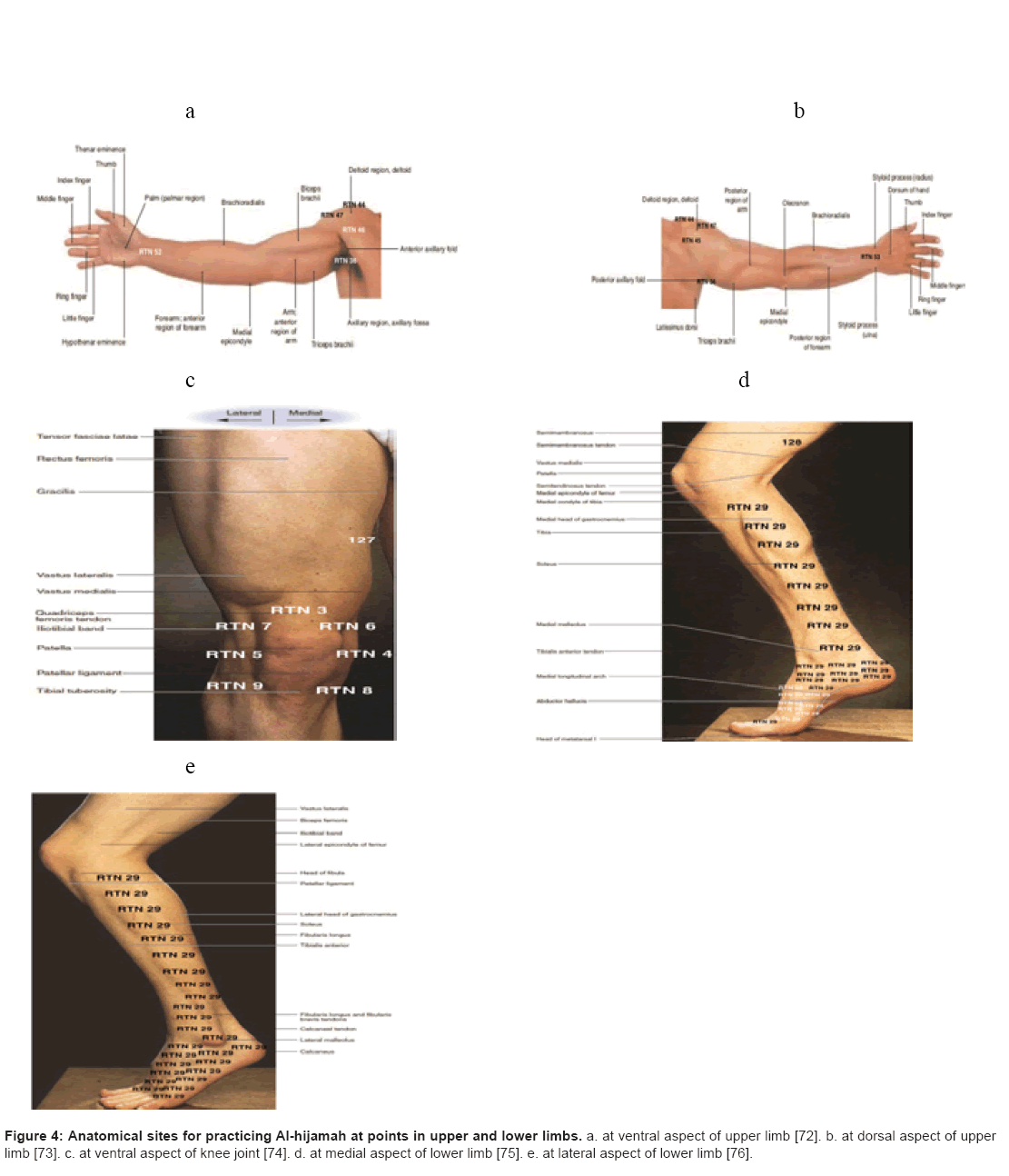 Hijama Cupping Points Chart