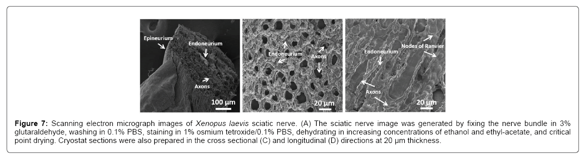 alzheimers-Relative-parkinsonism-fluorescence