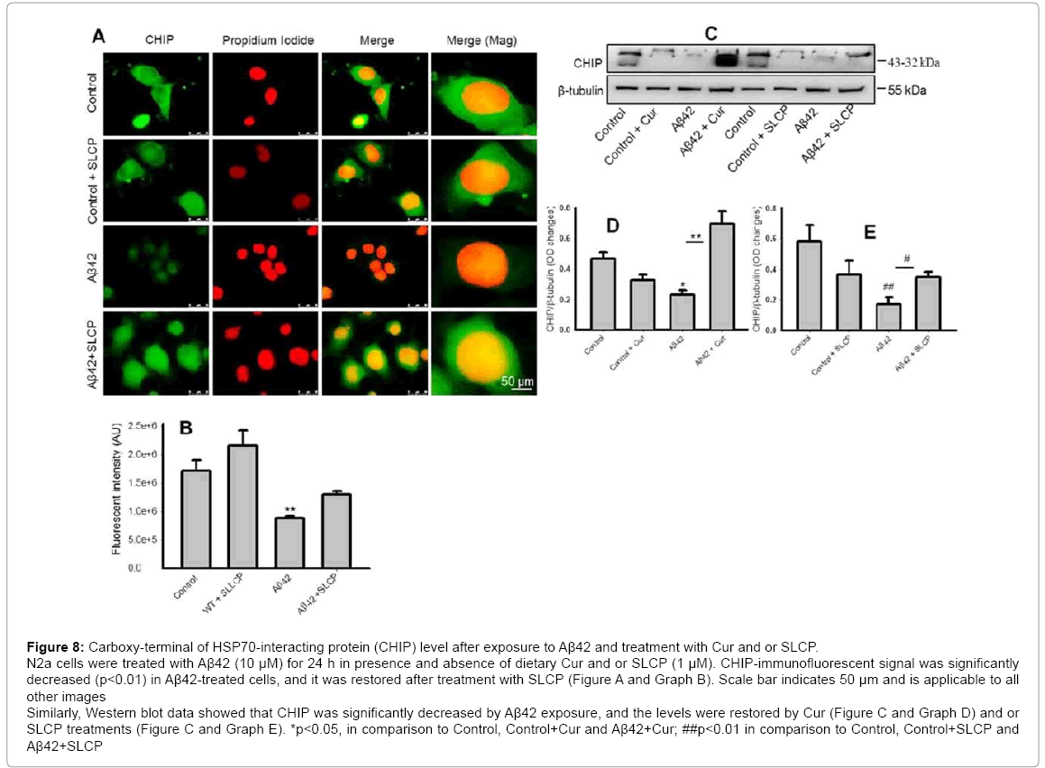 alzheimers-disease-parkinsonism-Carboxy-terminal