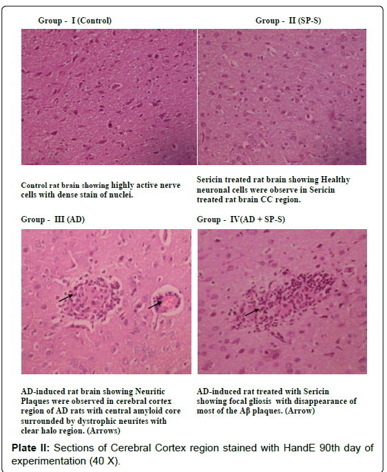 alzheimers-disease-parkinsonism-Cerebral-Cortex