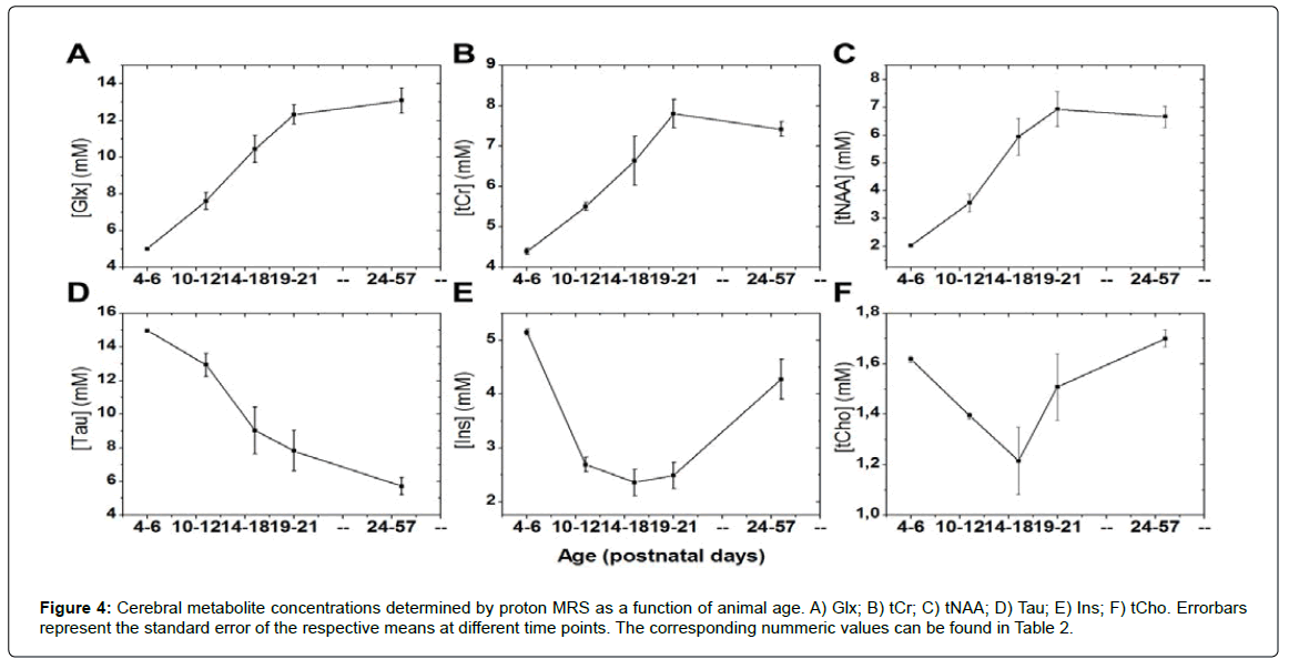 alzheimers-disease-parkinsonism-Cerebral-metabolite