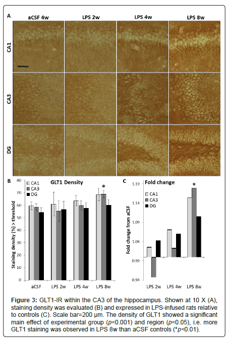 alzheimers-disease-parkinsonism-GLT1-staining