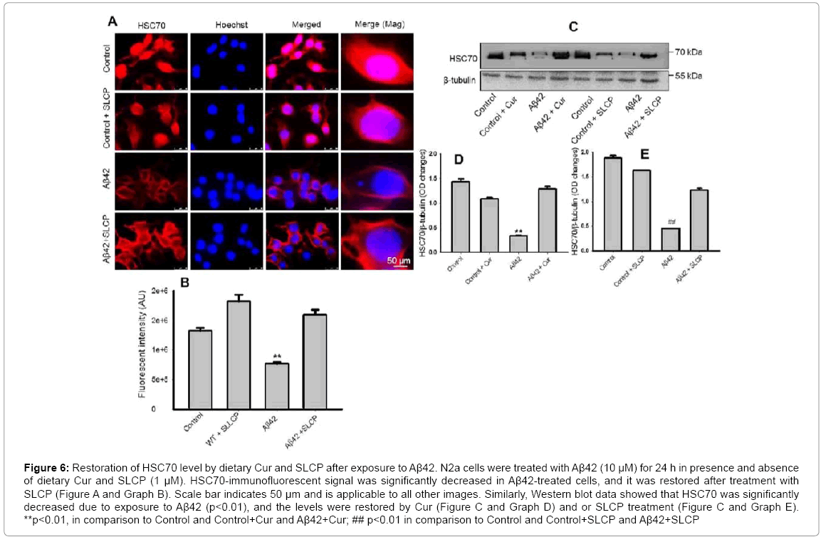 alzheimers-disease-parkinsonism-HSC70-immunofluorescent