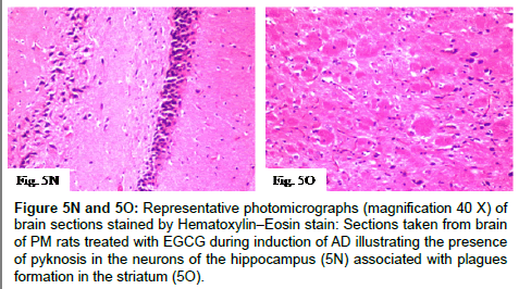 alzheimers-disease-parkinsonism-Hematoxylin–Eosin