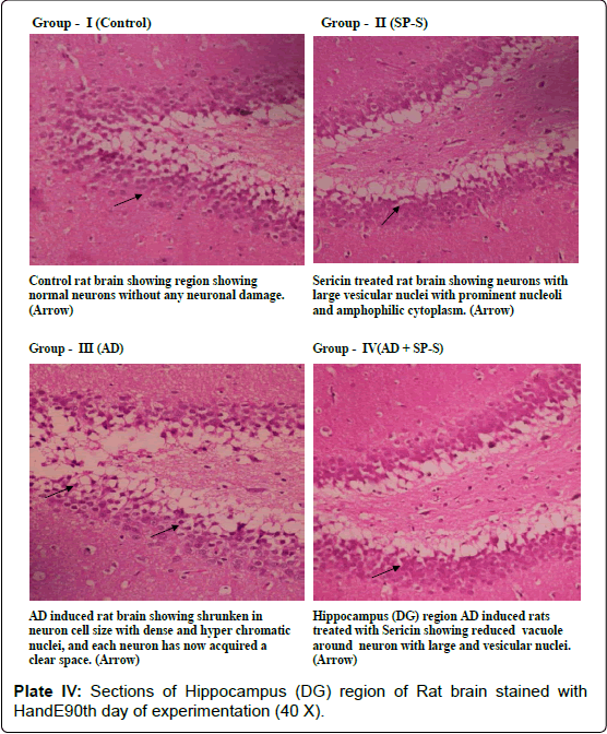 alzheimers-disease-parkinsonism-Rat-brain