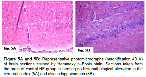 alzheimers-disease-parkinsonism-Representative
