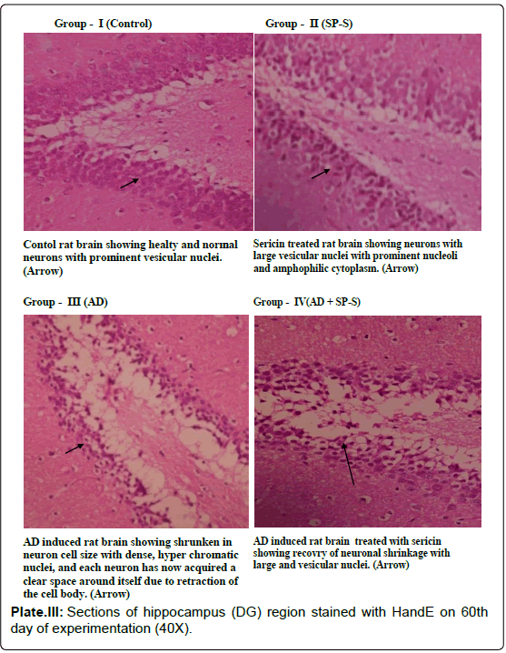alzheimers-disease-parkinsonism-Sections-hippocampus