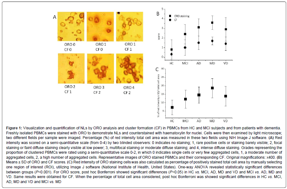 alzheimers-disease-parkinsonism-Visualization-quantification