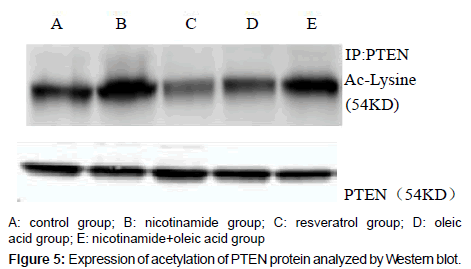 alzheimers-disease-parkinsonism-acetylation