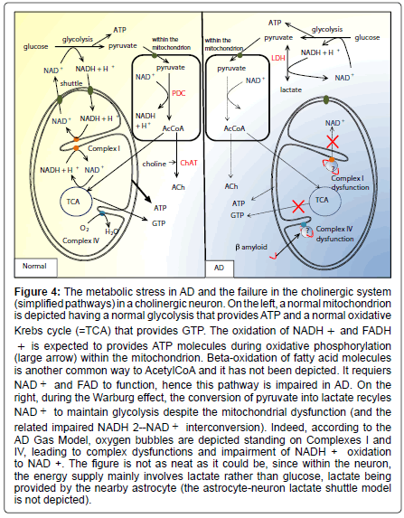 alzheimers-disease-parkinsonism-astrocyte-neuron