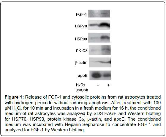 alzheimers-disease-parkinsonism-astrocytes-treated