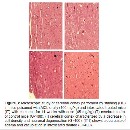 alzheimers-disease-parkinsonism-cerebral-cortex