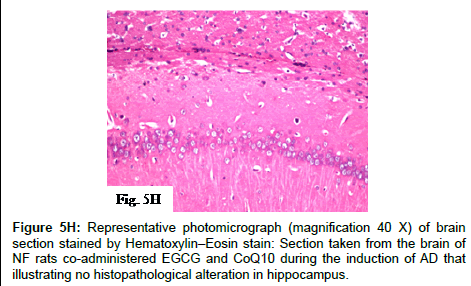 alzheimers-disease-parkinsonism-co-administered