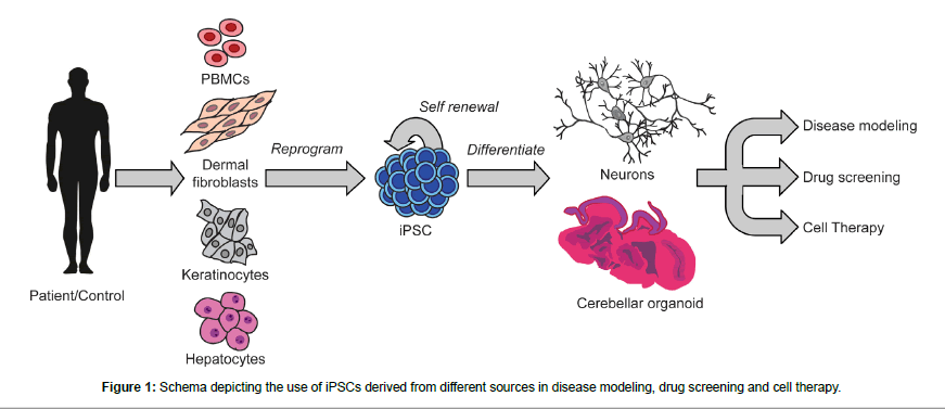 alzheimers-disease-parkinsonism-disease-modeling