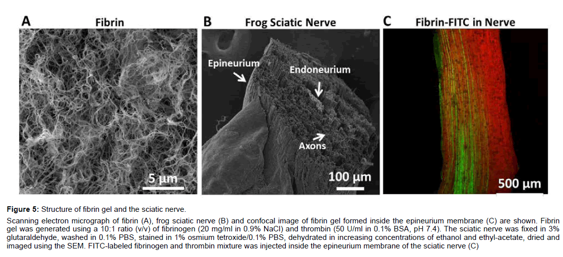 alzheimers-disease-parkinsonism-epineurium-membrane