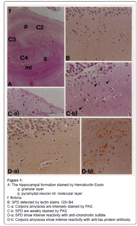 alzheimers-disease-parkinsonism-hippocampal-formation