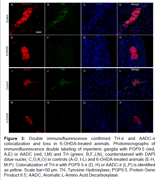 alzheimers-disease-parkinsonism-immunofluorescence-double