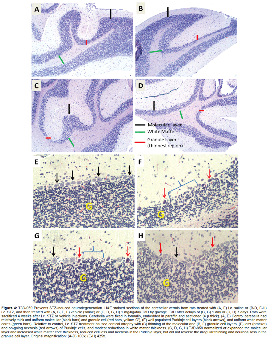 alzheimers-disease-parkinsonism-induced-neurodegeneration