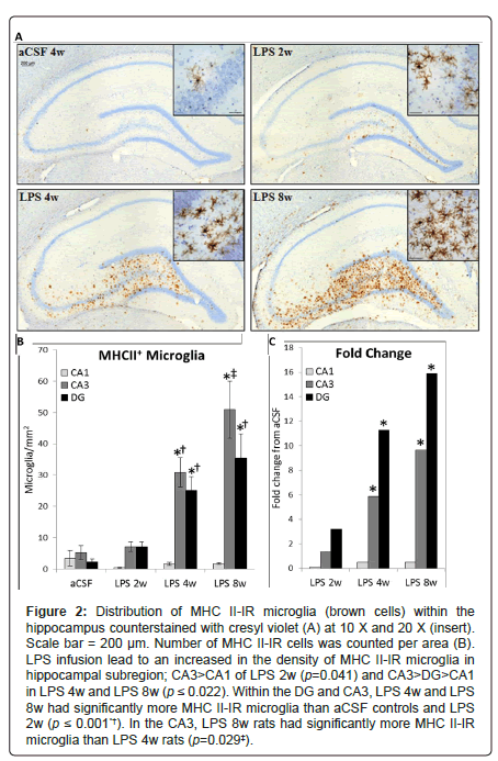 alzheimers-disease-parkinsonism-microglia-brown