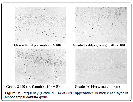 alzheimers-disease-parkinsonism-molecular-layer