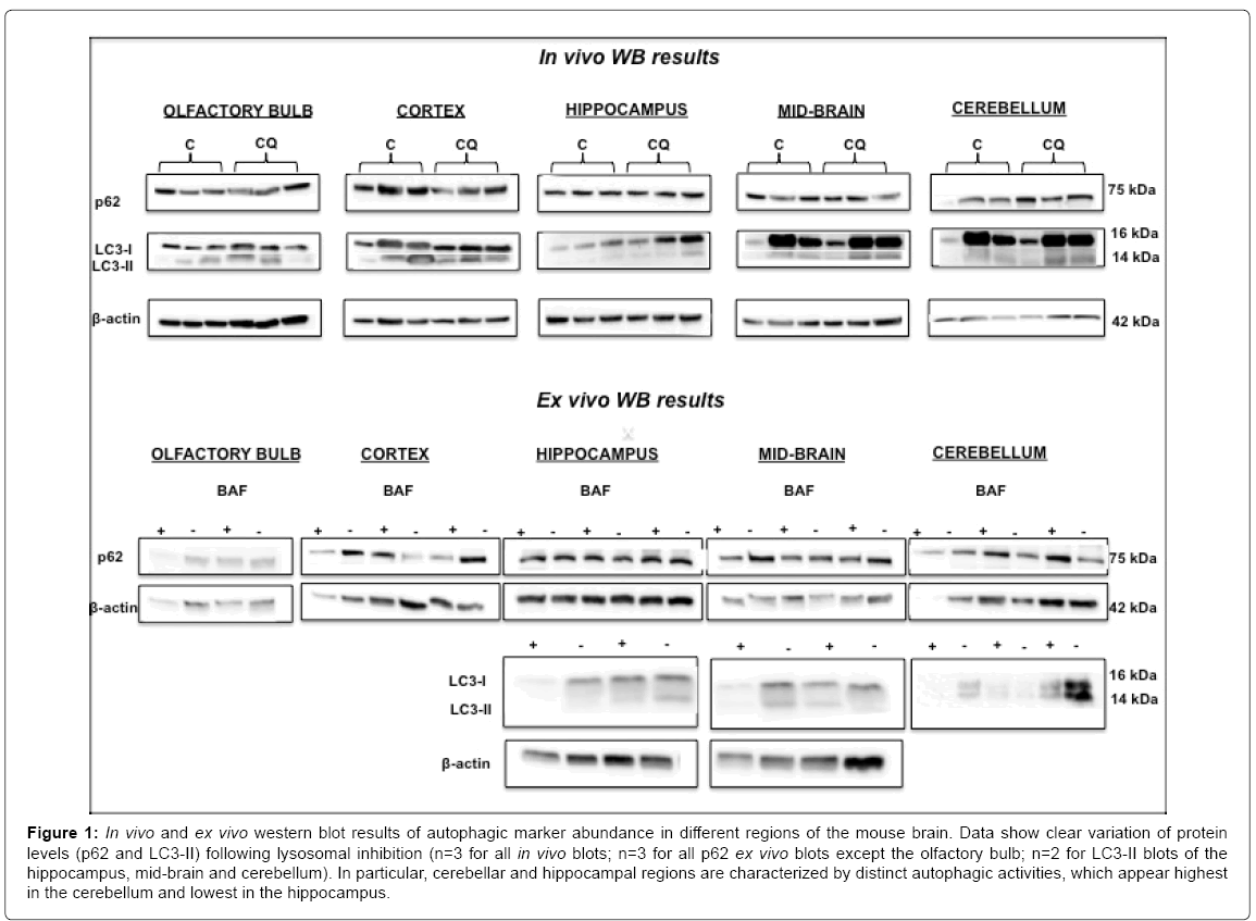 alzheimers-disease-parkinsonism-mouse-brain
