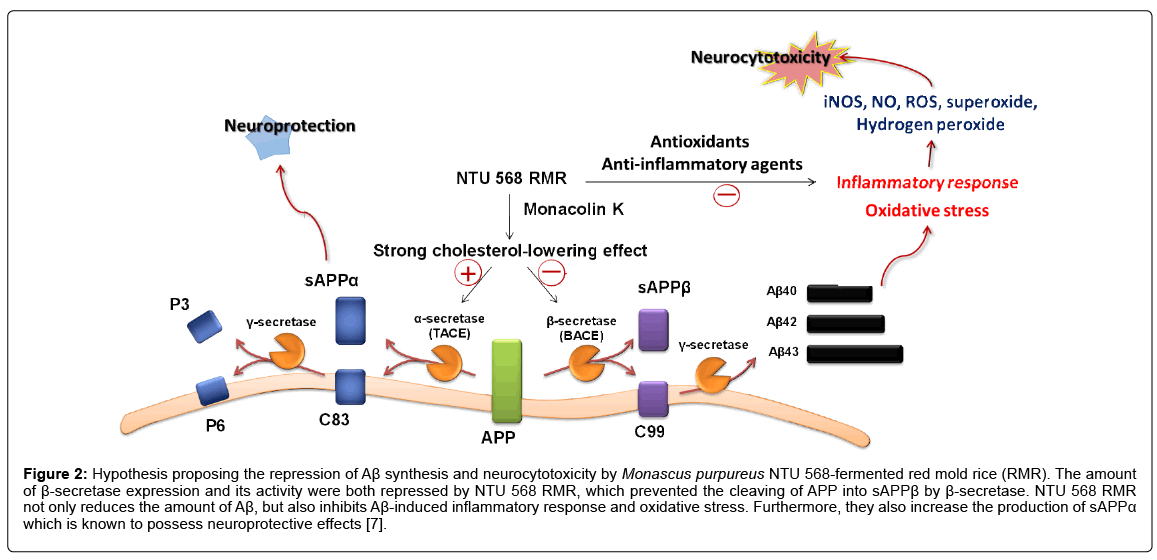 alzheimers-disease-parkinsonism-neurocytotoxicity