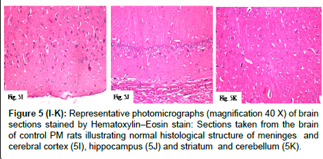 alzheimers-disease-parkinsonism-normal-histological