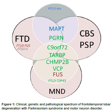 alzheimers-disease-parkinsonism-pathological-spectrum
