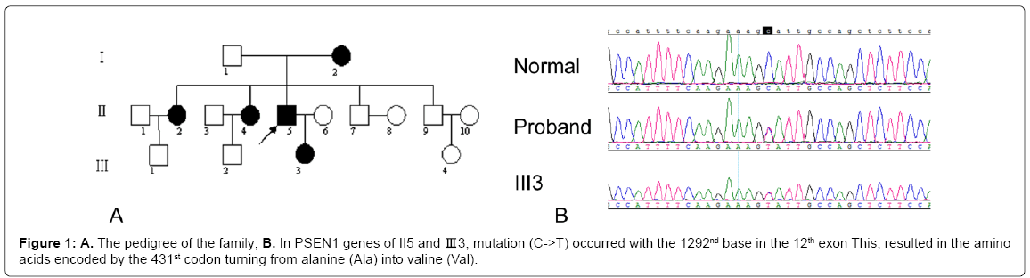 alzheimers-disease-parkinsonism-pedigree