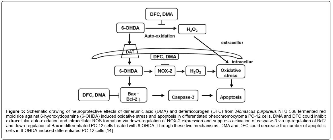 alzheimers-disease-parkinsonism-pheochromocytoma