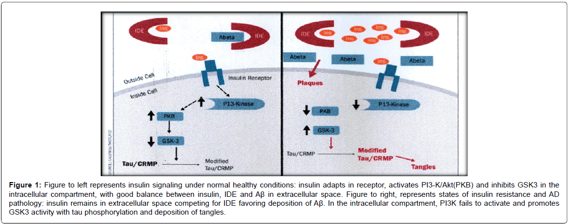 alzheimers-disease-parkinsonism-phosphorylation-deposition