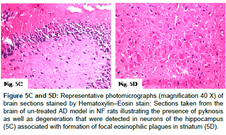 alzheimers-disease-parkinsonism-photomicrographs