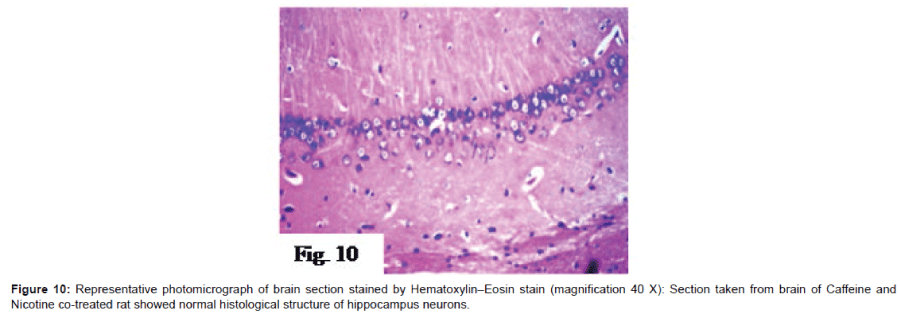 alzheimers-disease-parkinsonism-photomicrographs-brain