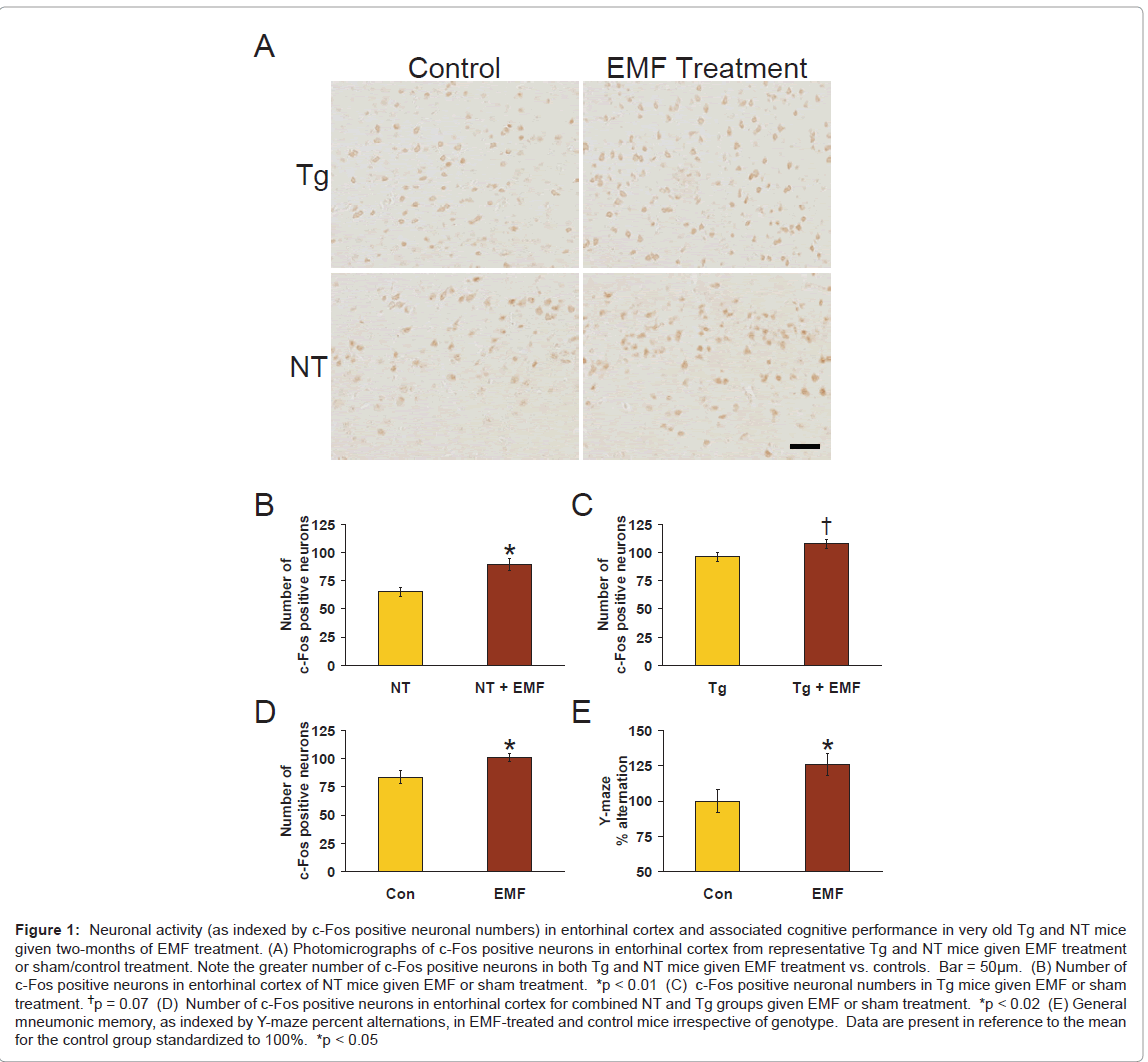 alzheimers-disease-parkinsonism-positive-neuronal