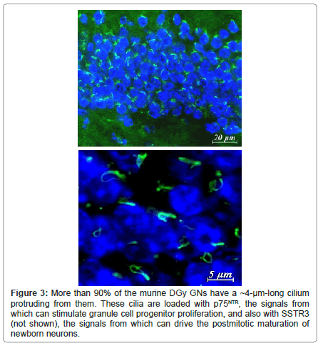 alzheimers-disease-parkinsonism-postmitotic-maturation