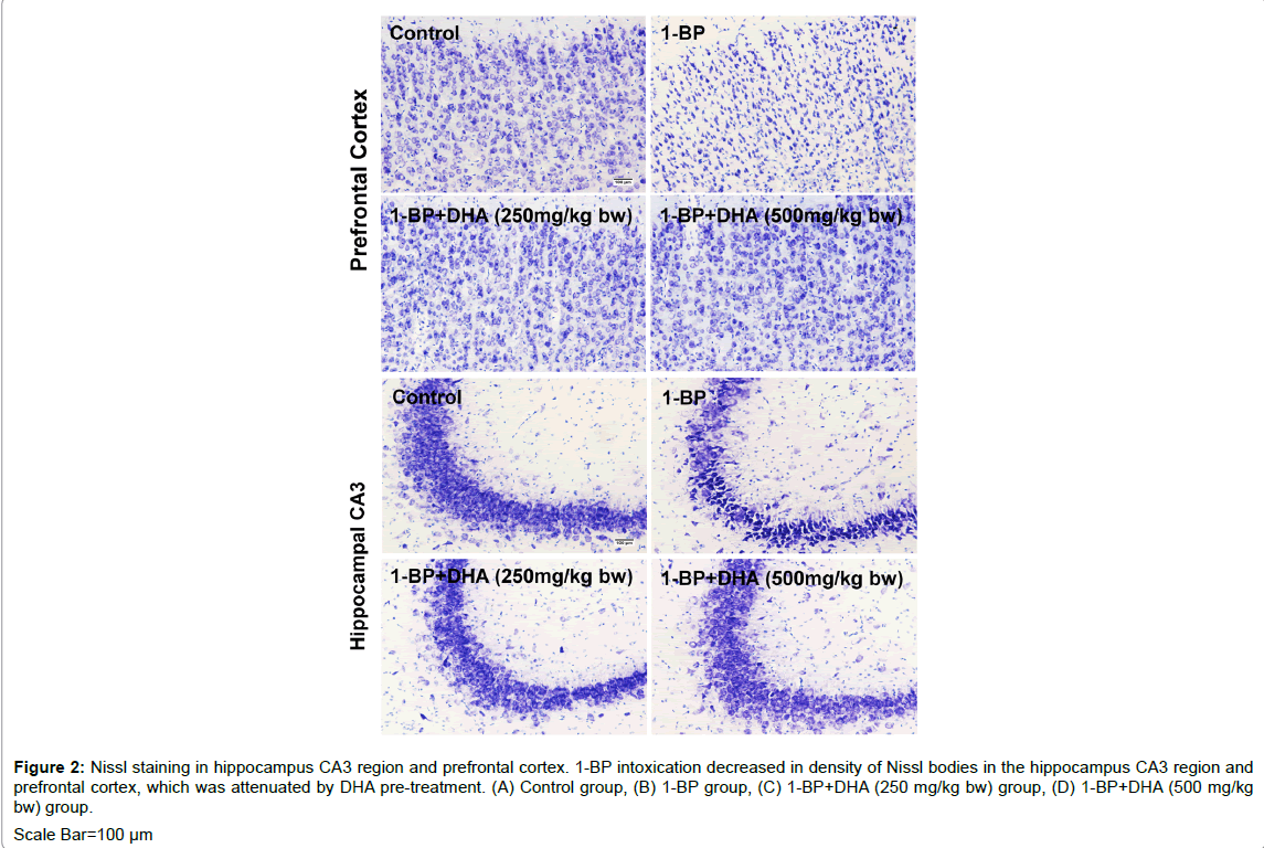 alzheimers-disease-parkinsonism-prefrontal-cortex