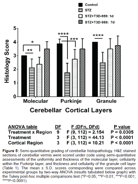 alzheimers-disease-parkinsonism-quantitative-grading