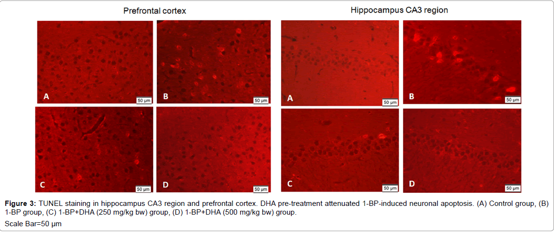 alzheimers-disease-parkinsonism-staining-hippocampus