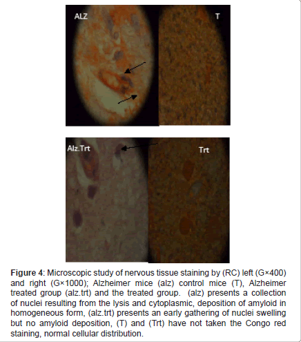 alzheimers-disease-parkinsonism-tissue-staining