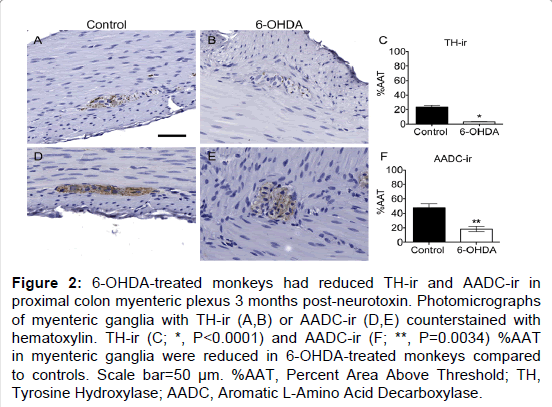 alzheimers-disease-parkinsonism-treated-monkeys