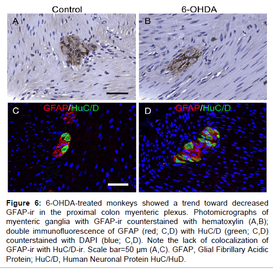 alzheimers-disease-parkinsonism-treated-monkeys